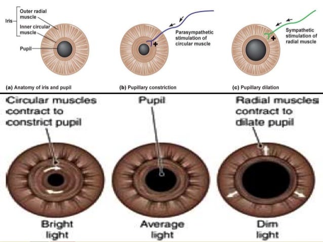 constriction of pupil constriction of pupil