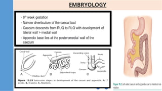 Vermiform Appendix Rabbit The Vermiform appendix - Dr Saket Bhardwaj | PPTX