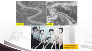 BEFORE AFTER
Children affected
by agent orange
 