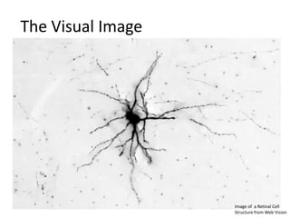 The Visual Image

Image of a Retinal Cell
Structure from Web Vision

 