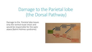 Damage to the Parietal lobe
(the Dorsal Pathway)
Damage to the Parietal lobe leaves
only the ventral route intact and
would be responsible for the optic
ataxia (Balint-Holmes syndrome)
 