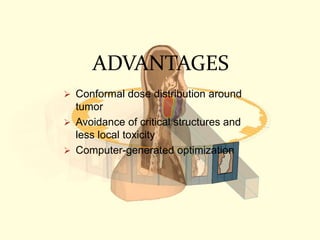 ADVANTAGES
 Conformal dose distribution around
tumor
 Avoidance of critical structures and
less local toxicity
 Computer-generated optimization
 