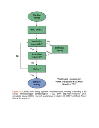 The_Walls_Manual_of_Emergency_Airway_Management_LWW_Wolters_Kluwer.pdf