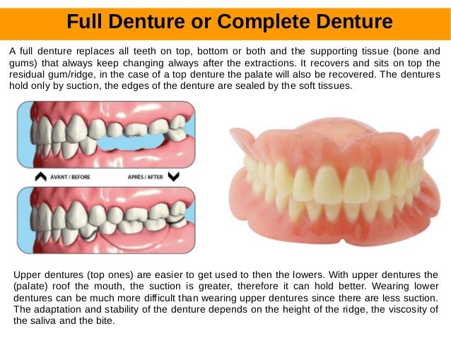 Denturologiste In West Island  - 20000 Trans Canada Highway | H9X 0B3, Baie D�urfe, Qc.