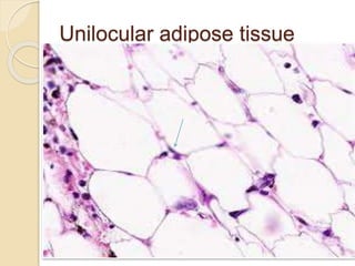 Unilocular adipose tissue
 