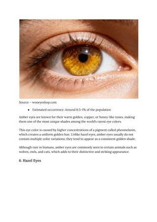 The World’s Rarest Eye Colors_ Genetics, Prevalence, and Fascinating ...