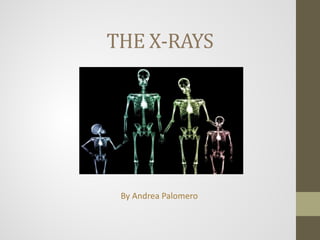 THE X-RAYS
By Andrea Palomero
 