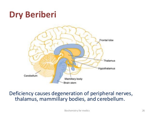 lack of beriberi lack of beriberi