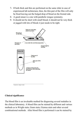 7- If both thick and thin are performed on the same slide in case of
experienced lab technicians; then, the thin part of the film will only
be fixed leaving out the bulged drop of blood on the frosted side.
8- A good smear is a one with parabolic tongue symmetry.
9- It should not be short with small blood; it should not be very thick
or jagged with lots of blood; it just needs to be right.
Clinical significance
The blood film is an invaluable method for diagnosing several maladies in
the clinical laboratory. A blood film can be stained by different and various
methods as in Wright stain, Gram stain, Giemsa stain and other several
combinational methods. After blood film is performed it can be stained by
 