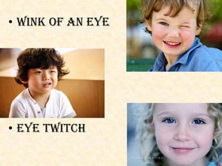 • Wink of an eye
• Eye twitch
 