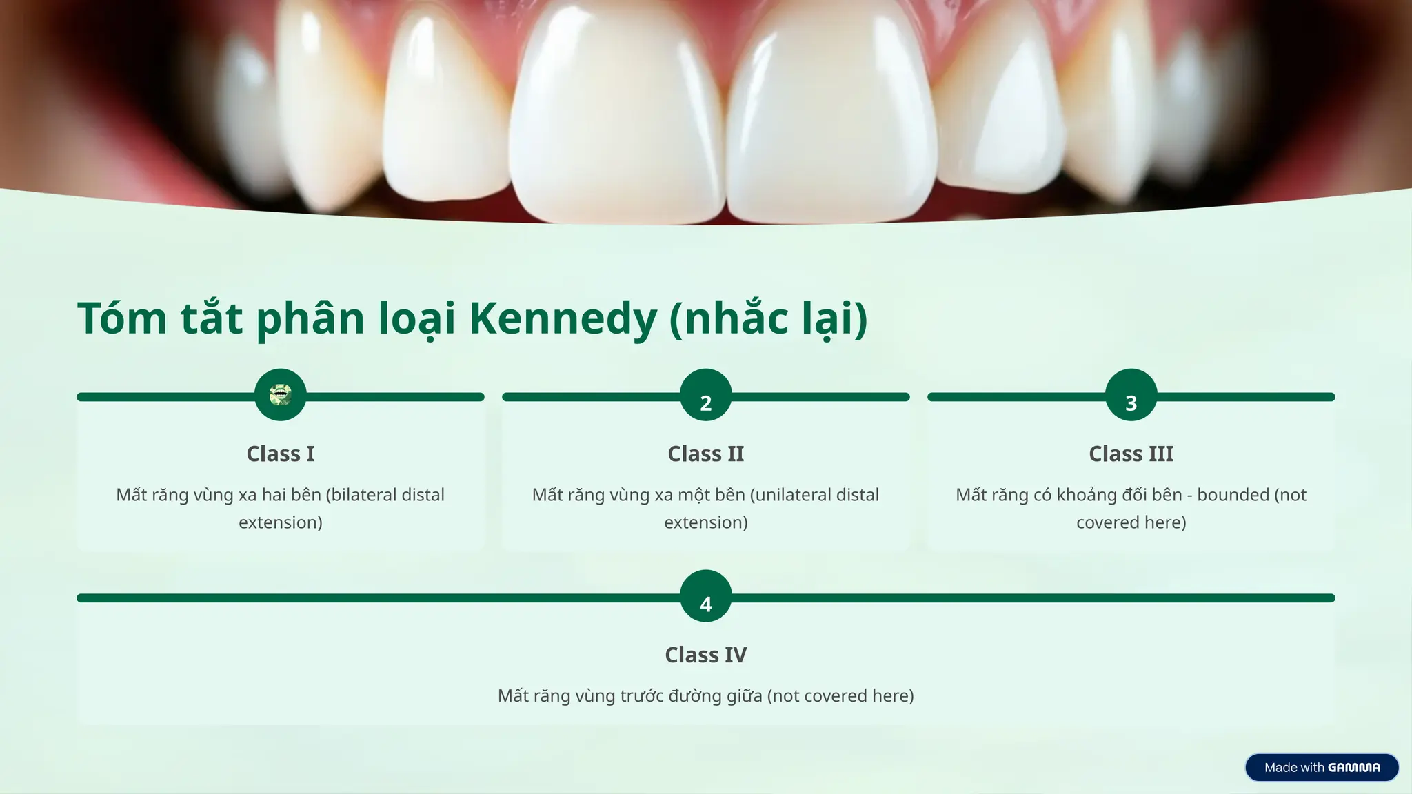 Tóm tắt phân loại Kennedy (nhắc lại)
Class I
Mất răng vùng xa hai bên (bilateral distal
extension)
2
Class II
Mất răng vùng xa một bên (unilateral distal
extension)
3
Class III
Mất răng có khoảng đối bên - bounded (not
covered here)
4
Class IV
Mất răng vùng trước đường giữa (not covered here)
 