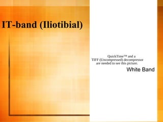 IT-band (Iliotibial)
QuickTime™ and a
TIFF (Uncompressed) decompressor
are needed to see this picture.
White Band
 