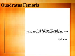 Quadratus Femoris
QuickTime™ and a
TIFF (Uncompressed) decompressor
are needed to see this picture.
<--Here
 