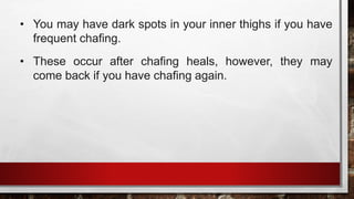 THIGH CHAFING.pptx