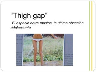 “Thigh gap”
El espacio entre muslos, la última obsesión
adolescente
 