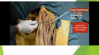 Superficial
vessel on medial
side of thigh
 