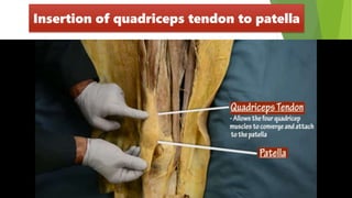 Insertion of quadriceps tendon to patella
 
