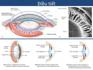 CẤU TẠO GIẢI PHẪU CỦA MẮT BAO GỒM THỂ THỦY TINH VÀ CÁC BỘ PHẬN LIÊN QUAN