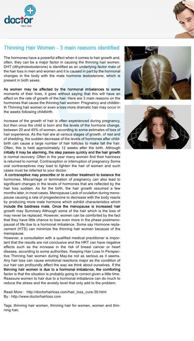 Thinning Hair Women L Doctor Hair Loss
