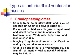 Types of anterior third ventricular
masses
6. Craniopharyngiomas
 Usually from the pituitary stalk, and in young
children (in whom it’s always calcified).
 Presented in children with growth impairment
and visual defects; and in adults with
hydrocephalus, VF defects, behavioral and
mental changes.
 Imaging: irregular outlines with calcifications
and cysts, variable enhancement.
 Shunting done if there is hydrocephalus. The
aim of treatment is total removal.Radiation
may be helpful.
 