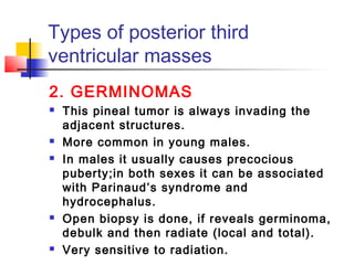Types of posterior third
ventricular masses
2. GERMINOMAS
 This pineal tumor is always invading the
adjacent structures.
 More common in young males.
 In males it usually causes precocious
puberty;in both sexes it can be associated
with Parinaud’s syndrome and
hydrocephalus.
 Open biopsy is done, if reveals germinoma,
debulk and then radiate (local and total).
 Very sensitive to radiation.
 