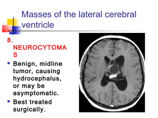 Masses of the lateral cerebral
ventricle
8.
NEUROCYTOMA
S
 Benign, midline
tumor, causing
hydrocephalus,
or may be
asymptomatic.
 Best treated
surgically.
 