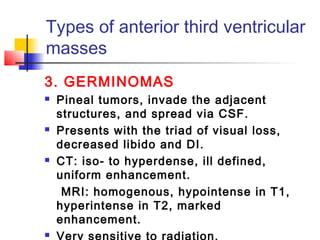 Types of anterior third ventricular
masses
3. GERMINOMAS
 Pineal tumors, invade the adjacent
structures, and spread via CSF.
 Presents with the triad of visual loss,
decreased libido and DI.
 CT: iso- to hyperdense, ill defined,
uniform enhancement.
MRI: homogenous, hypointense in T1,
hyperintense in T2, marked
enhancement.
 Very sensitive to radiation.
 