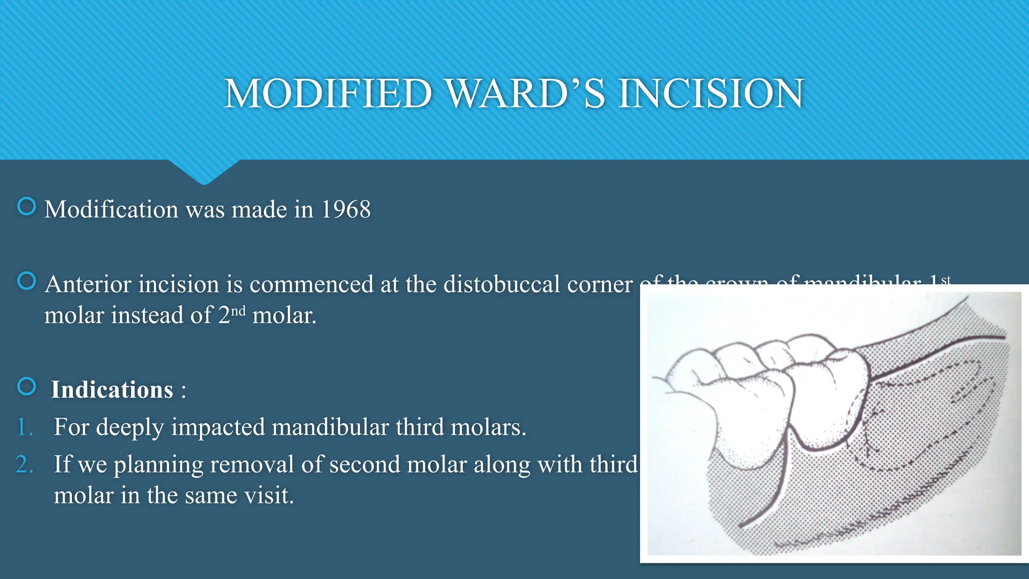 MODIFIED WARD’S INCISION
 Modification was made in 1968
 Anterior incision is commenced at the distobuccal corner of the crown of mandibular 1st
molar instead of 2nd
molar.
 Indications :
1. For deeply impacted mandibular third molars.
2. If we planning removal of second molar along with third
molar in the same visit.
 