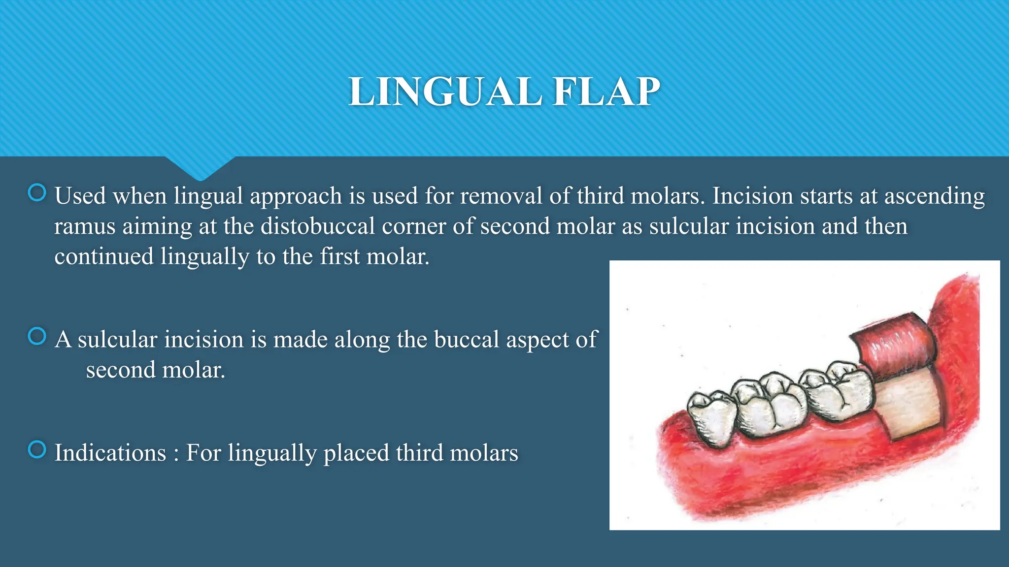 LINGUAL FLAP
 Used when lingual approach is used for removal of third molars. Incision starts at ascending
ramus aiming at the distobuccal corner of second molar as sulcular incision and then
continued lingually to the first molar.
 A sulcular incision is made along the buccal aspect of
second molar.
 Indications : For lingually placed third molars
 