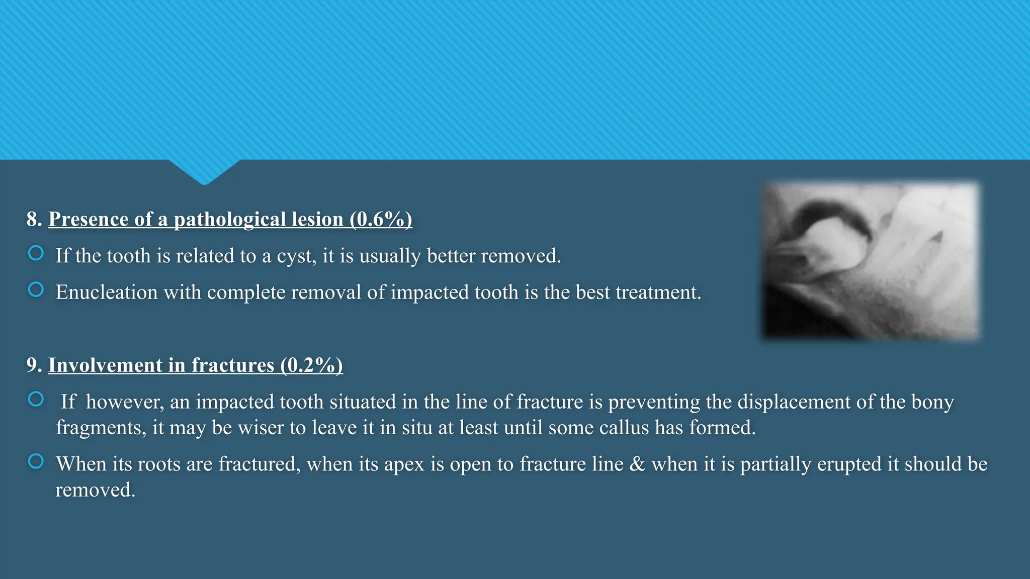 8. Presence of a pathological lesion (0.6%)
 If the tooth is related to a cyst, it is usually better removed.
 Enucleation with complete removal of impacted tooth is the best treatment.
9. Involvement in fractures (0.2%)
 If however, an impacted tooth situated in the line of fracture is preventing the displacement of the bony
fragments, it may be wiser to leave it in situ at least until some callus has formed.
 When its roots are fractured, when its apex is open to fracture line & when it is partially erupted it should be
removed.
 