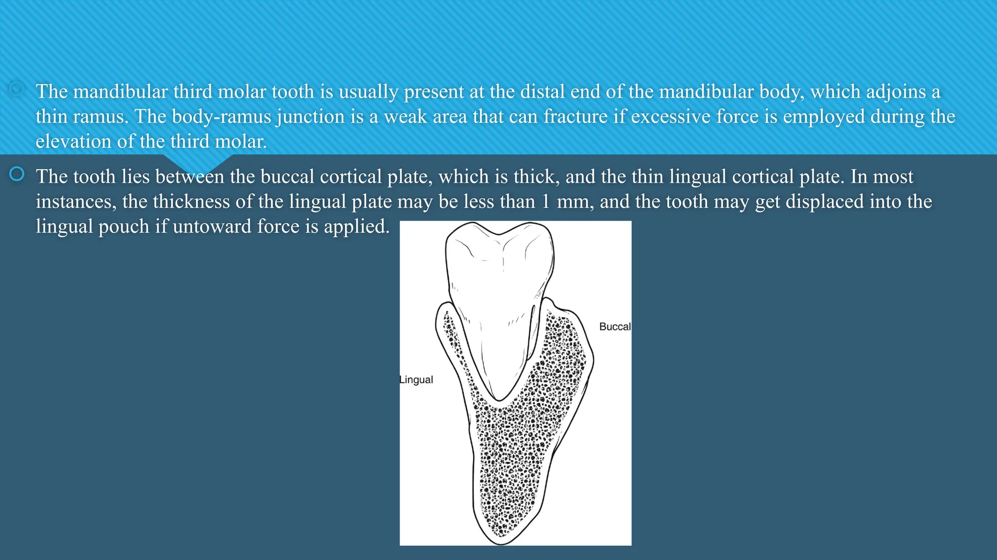  The mandibular third molar tooth is usually present at the distal end of the mandibular body, which adjoins a
thin ramus. The body-ramus junction is a weak area that can fracture if excessive force is employed during the
elevation of the third molar.
 The tooth lies between the buccal cortical plate, which is thick, and the thin lingual cortical plate. In most
instances, the thickness of the lingual plate may be less than 1 mm, and the tooth may get displaced into the
lingual pouch if untoward force is applied.
 