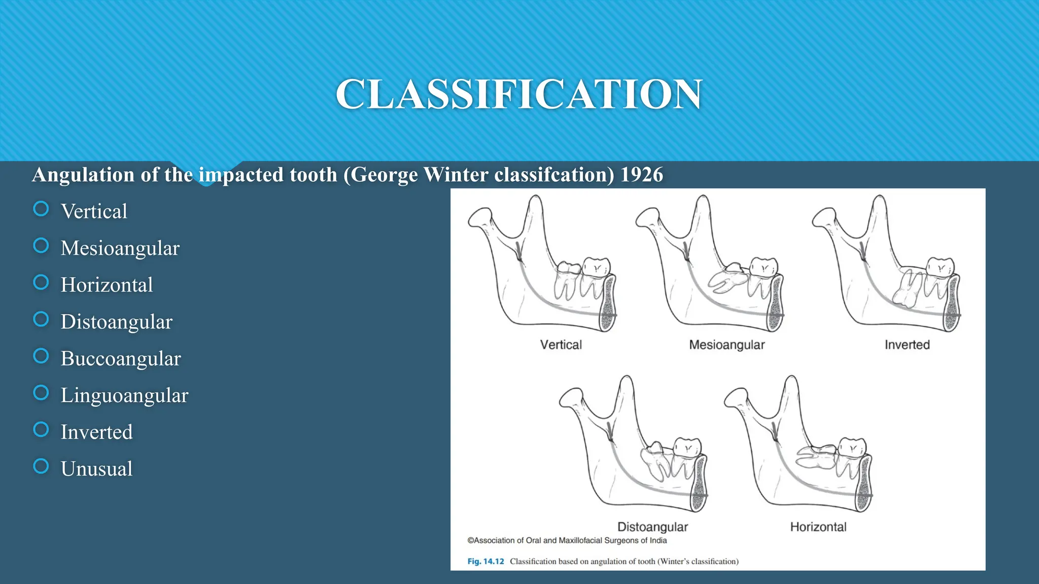 CLASSIFICATION
Angulation of the impacted tooth (George Winter classifcation) 1926
 Vertical
 Mesioangular
 Horizontal
 Distoangular
 Buccoangular
 Linguoangular
 Inverted
 Unusual
 