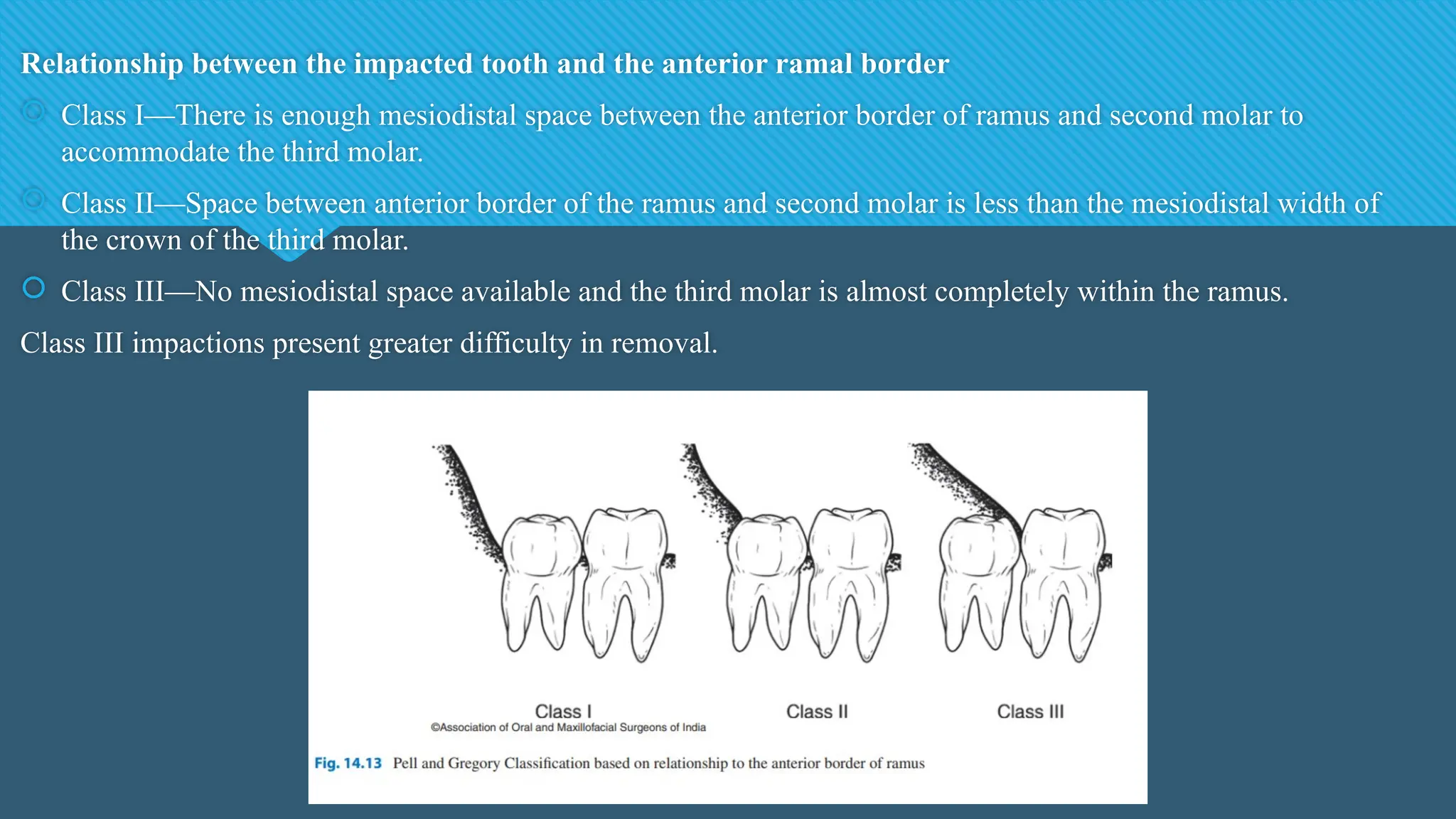 Relationship between the impacted tooth and the anterior ramal border
 Class I—There is enough mesiodistal space between the anterior border of ramus and second molar to
accommodate the third molar.
 Class II—Space between anterior border of the ramus and second molar is less than the mesiodistal width of
the crown of the third molar.
 Class III—No mesiodistal space available and the third molar is almost completely within the ramus.
Class III impactions present greater difficulty in removal.
 