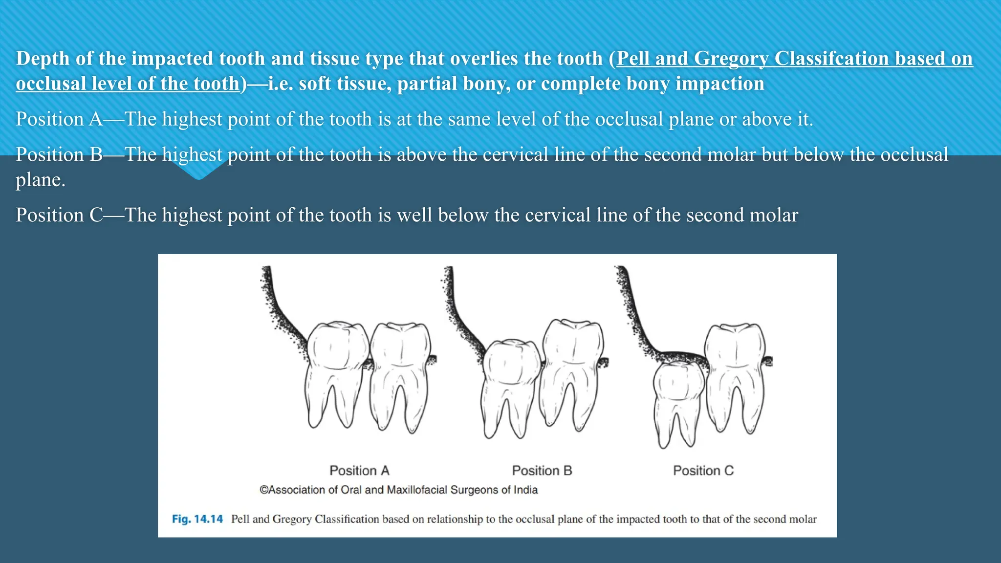 Depth of the impacted tooth and tissue type that overlies the tooth (Pell and Gregory Classifcation based on
occlusal level of the tooth)—i.e. soft tissue, partial bony, or complete bony impaction
Position A—The highest point of the tooth is at the same level of the occlusal plane or above it.
Position B—The highest point of the tooth is above the cervical line of the second molar but below the occlusal
plane.
Position C—The highest point of the tooth is well below the cervical line of the second molar
 