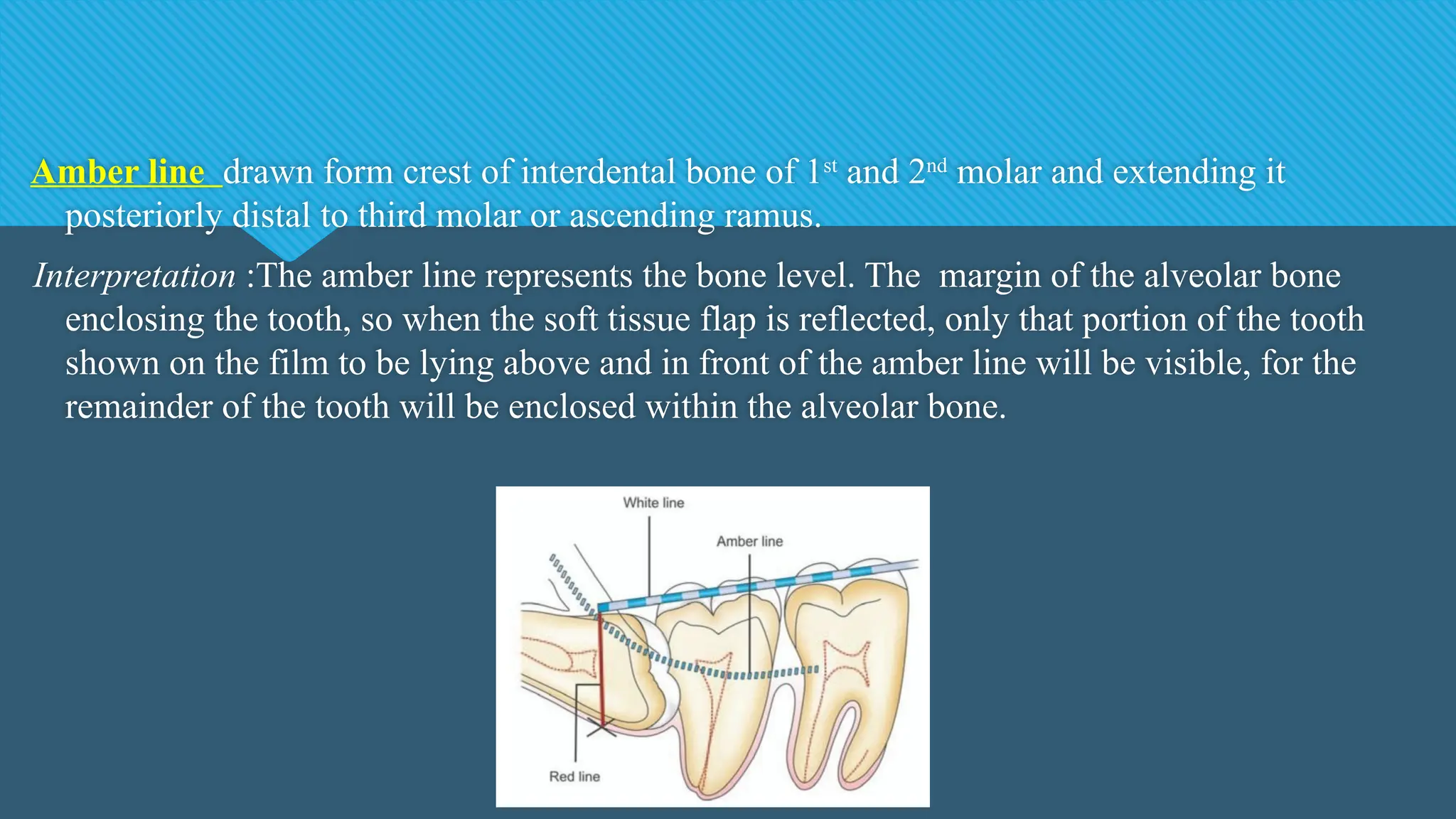 Amber line drawn form crest of interdental bone of 1st
and 2nd
molar and extending it
posteriorly distal to third molar or ascending ramus.
Interpretation :The amber line represents the bone level. The margin of the alveolar bone
enclosing the tooth, so when the soft tissue flap is reflected, only that portion of the tooth
shown on the film to be lying above and in front of the amber line will be visible, for the
remainder of the tooth will be enclosed within the alveolar bone.
 