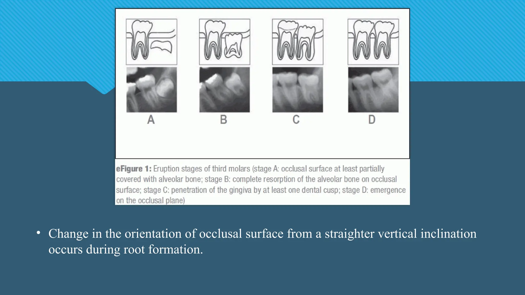 • Change in the orientation of occlusal surface from a straighter vertical inclination
occurs during root formation.
 