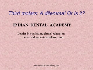 Third molars: A dilemma! Or is it?
INDIAN DENTAL ACADEMY
Leader in continuing dental education
www.indiandentalacademy.com
www.indiandentalacademy.com
 