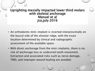 Uprighting mesially impacted lower third molars
with skeletal anchorage
Manuel et al
jco,july 2016
• An orthodontic mini-implant is inserted interproximally on
the buccal side of the alveolar ridge, with the exact
location determined by clinical and radiographic
assessment of the available space.
• With direct anchorage from the mini-implants, there is no
risk of anchorage loss or undesired tooth movement.
Extraction and associated risks such as nerve damage,
TMD, and improper wound healing are avoided.
 