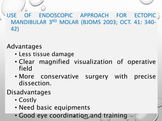 USE OF ENDOSCOPIC APPROACH FOR ECTOPIC
MANDIBULAR 3RD MOLAR (BJOMS 2003; OCT. 41: 340-
42)
Advantages
• Less tissue damage
• Clear magnified visualization of operative
field
• More conservative surgery with precise
dissection.
Disadvantages
• Costly
• Need basic equipments
• Good eye coordination and training
 