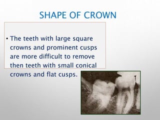 SHAPE OF CROWN
• The teeth with large square
crowns and prominent cusps
are more difficult to remove
then teeth with small conical
crowns and flat cusps.
 