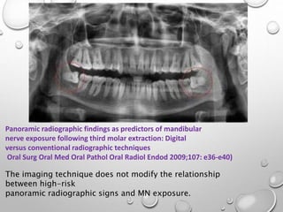 Panoramic radiographic findings as predictors of mandibular
nerve exposure following third molar extraction: Digital
versus conventional radiographic techniques
Oral Surg Oral Med Oral Pathol Oral Radiol Endod 2009;107: e36-e40)
The imaging technique does not modify the relationship
between high-risk
panoramic radiographic signs and MN exposure.
 