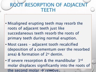 ROOT RESORPTION OF ADJACENT
TEETH
• Misaligned erupting teeth may resorb the
roots of adjacent teeth just like
succedaneous teeth resorb the roots of
primary teeth during normal eruption.
• Most cases - adjacent tooth recalcified
(deposition of a cementum over the resorbed
area) & formation of 2o dentin.
• If severe resorption & the mandibular 3rd
molar displaces significantly into the roots of
the second molar  remove.
 