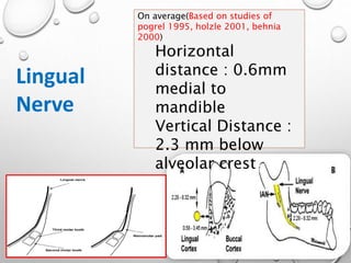 On average(Based on studies of
pogrel 1995, holzle 2001, behnia
2000)
Horizontal
distance : 0.6mm
medial to
mandible
Vertical Distance :
2.3 mm below
alveolar crest
Lingual
Nerve
 
