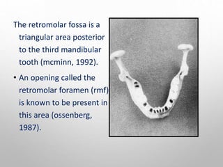 The retromolar fossa is a
triangular area posterior
to the third mandibular
tooth (mcminn, 1992).
• An opening called the
retromolar foramen (rmf)
is known to be present in
this area (ossenberg,
1987).
 