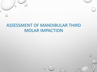 ASSESSMENT OF MANDIBULAR THIRD
MOLAR IMPACTION
 