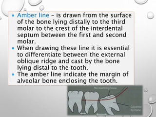  Amber line – is drawn from the surface
of the bone lying distally to the third
molar to the crest of the interdental
septum between the first and second
molar.
 When drawing these line it is essential
to differentiate between the external
oblique ridge and cast by the bone
lying distal to the tooth.
 The amber line indicate the margin of
alveolar bone enclosing the tooth.
 