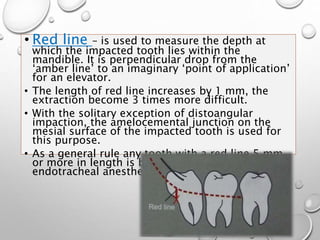 • Red line – is used to measure the depth at
which the impacted tooth lies within the
mandible. It is perpendicular drop from the
‘amber line’ to an imaginary ‘point of application’
for an elevator.
• The length of red line increases by 1 mm, the
extraction become 3 times more difficult.
• With the solitary exception of distoangular
impaction, the amelocemental junction on the
mesial surface of the impacted tooth is used for
this purpose.
• As a general rule any tooth with a red line 5 mm
or more in length is better removed under an
endotracheal anesthetic.
 
