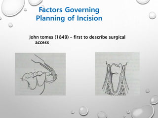 Factors Governing
Planning of Incision
John tomes (1849) – first to describe surgical
access
 
