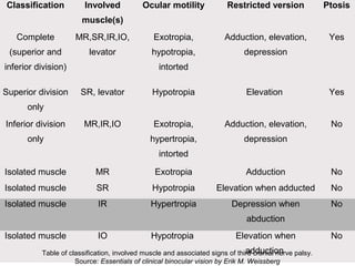 Classification Involved
muscle(s)
Ocular motility Restricted version Ptosis
Complete
(superior and
inferior division)
MR,SR,IR,IO,
levator
Exotropia,
hypotropia,
intorted
Adduction, elevation,
depression
Yes
Superior division
only
SR, levator Hypotropia Elevation Yes
Inferior division
only
MR,IR,IO Exotropia,
hypertropia,
intorted
Adduction, elevation,
depression
No
Isolated muscle MR Exotropia Adduction No
Isolated muscle SR Hypotropia Elevation when adducted No
Isolated muscle IR Hypertropia Depression when
abduction
No
Isolated muscle IO Hypotropia Elevation when
adduction
No
Table of classification, involved muscle and associated signs of third cranial nerve palsy.
Source: Essentials of clinical binocular vision by Erik M. Weissberg
 