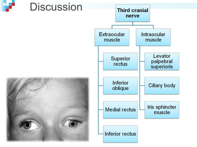 Case presentation: Third nerve palsy | PPT